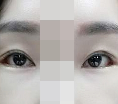 현대미학베스트셀피